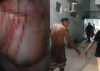 Homem é sequestrado e torturado em Teresina; família pagou R$ 800 por resgate