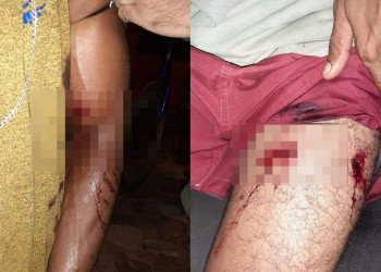 Dupla sofre tentativa de homicídio no interior do Piauí; suspeitos são identificados